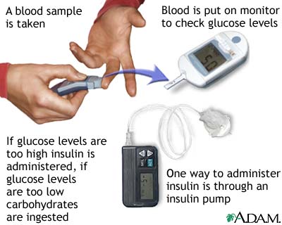 Insulin test