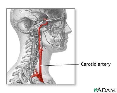 Carotid artery anatomy