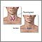 Incision for thyroid gland surgery
